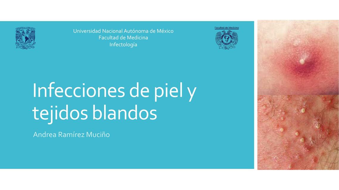 Infecciones de piel y tejidos blandos