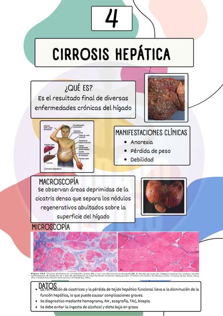 CIRROSIS HEPÁTICA