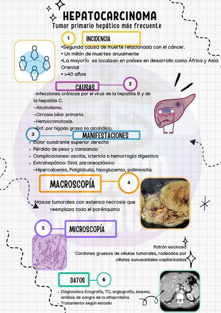 HEPATOCARCINOMA