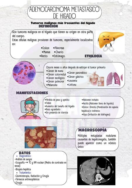 ADENOCARCINOMA METASTÁSICO DE HÍGADO