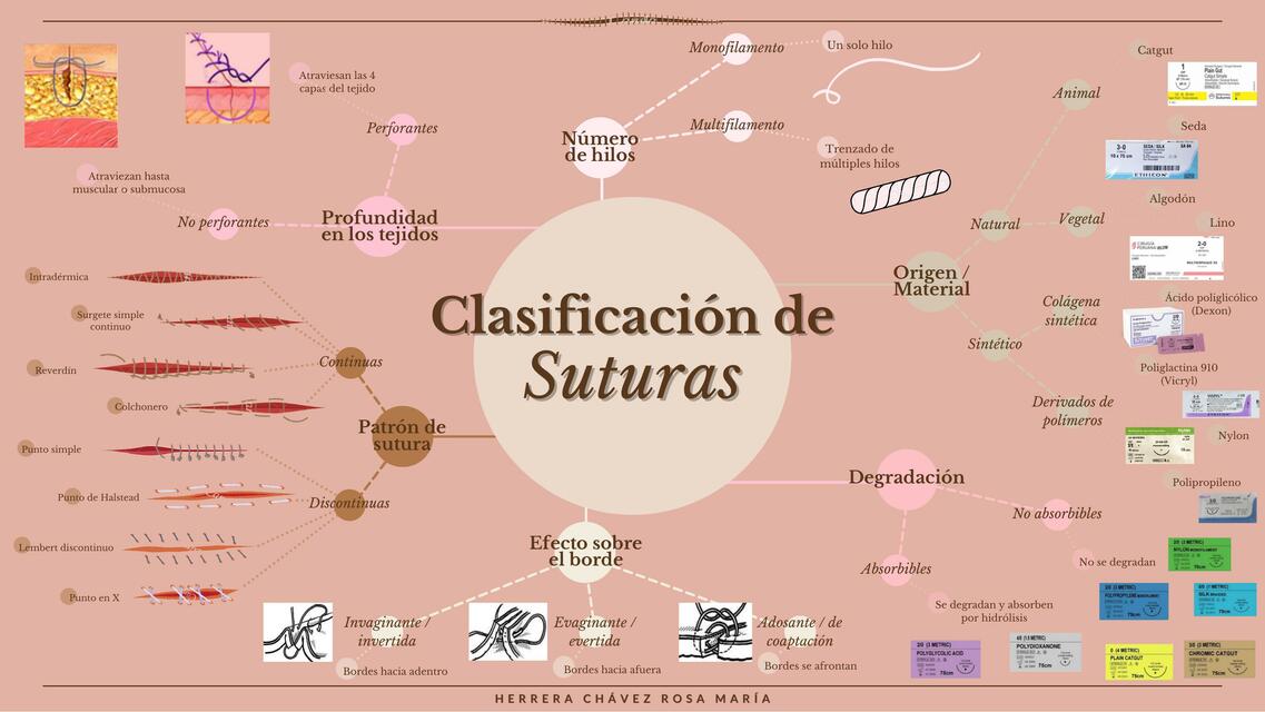 Clasificación de Suturas 