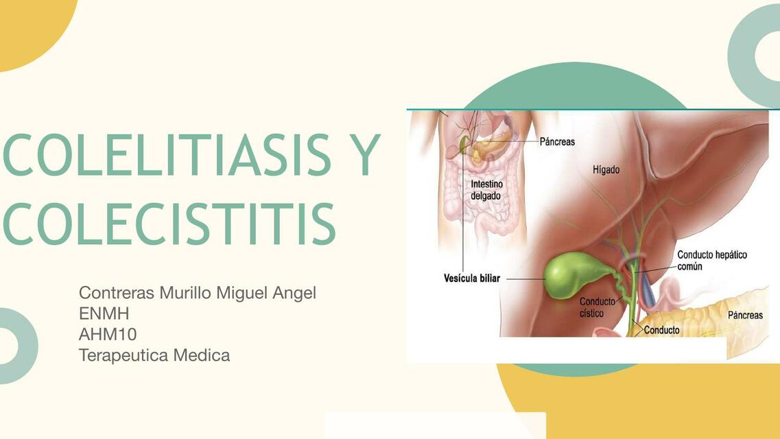 Colecistitis y Colelitiasis