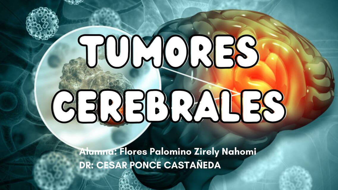 TUMORES CEREBRALES