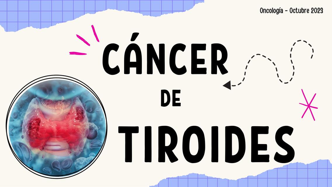 Cáncer de tiroides