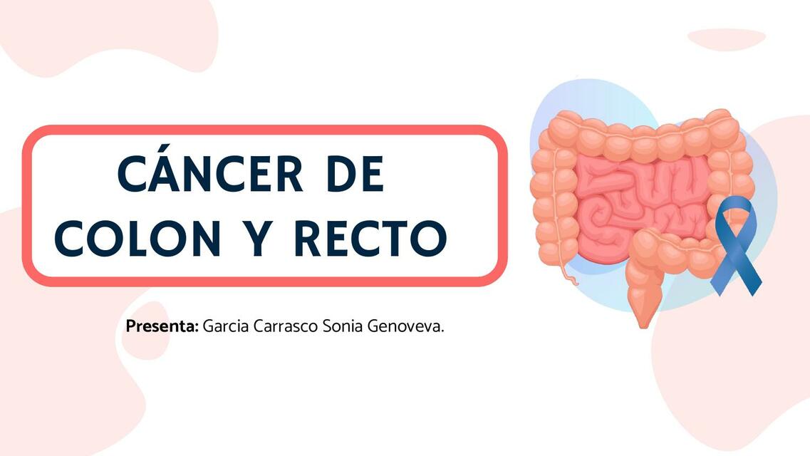 Cancer de colón y recto