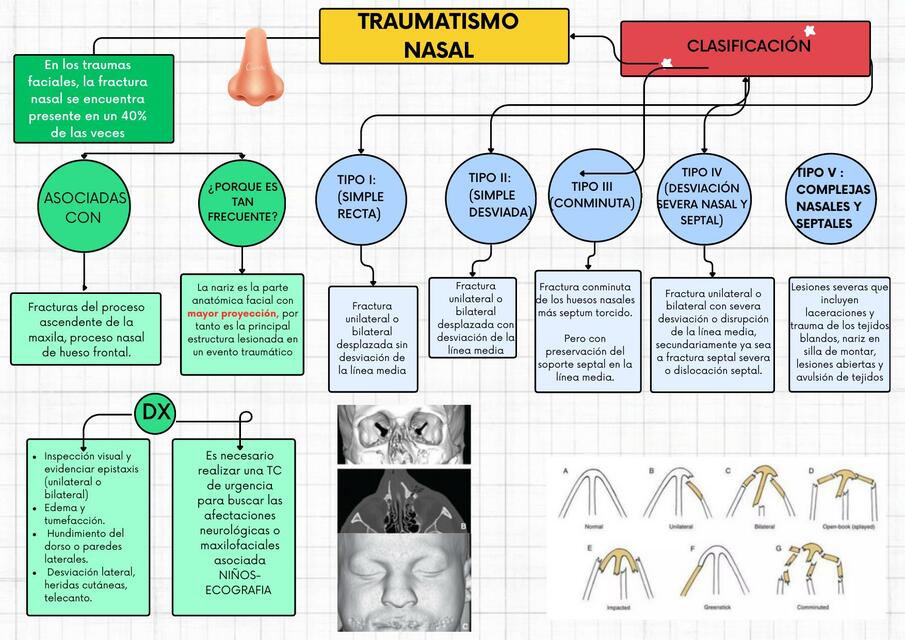 Traumatismo nasal 