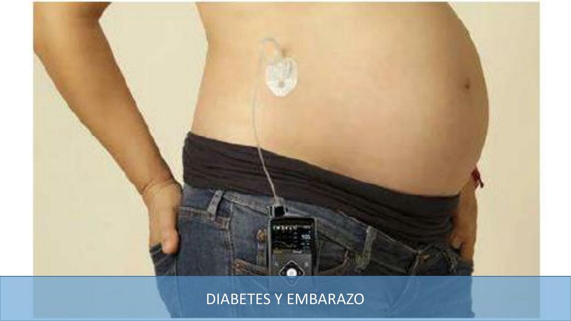 DIABETES Y EMBARAZO