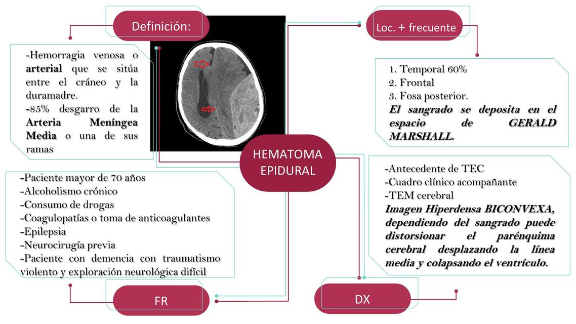 Hemato epidural