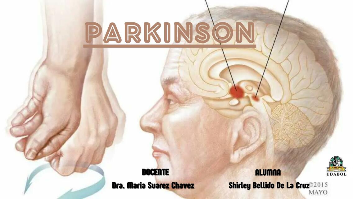 Parkinson 