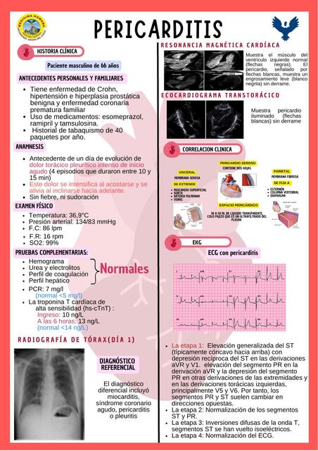 PERICARDITIS 1