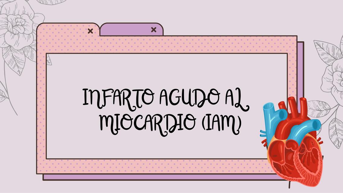 INFARTO AGUDO AL MIOCARDIOIAM