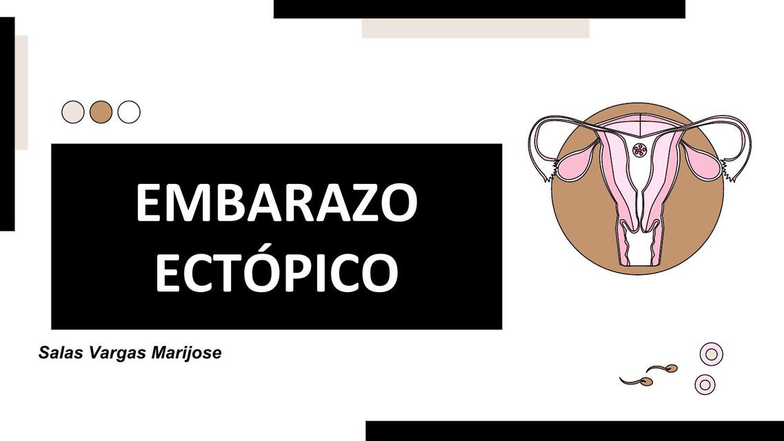 Embarazo ectópico 