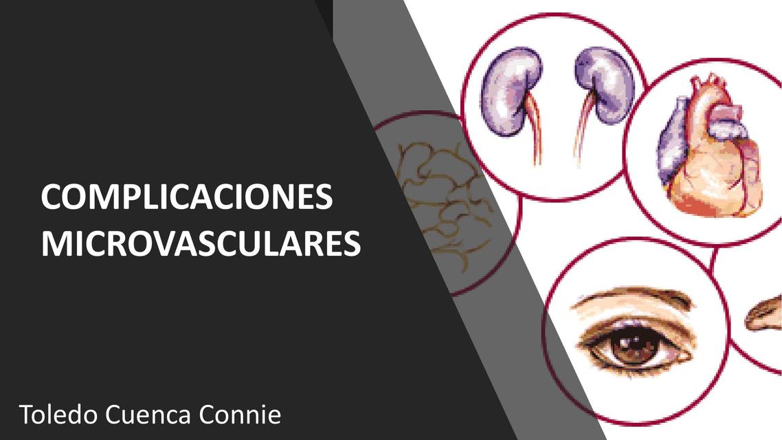 COMPLICACIONES MICROVASCULARES DIABETES