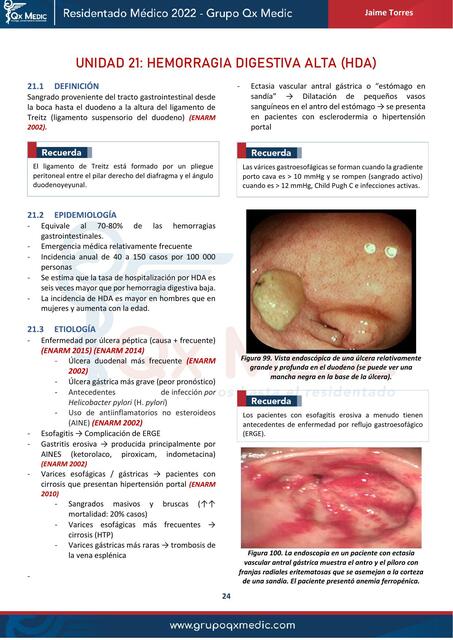 HEMORRAGIA DIGESTIVA ALTA2