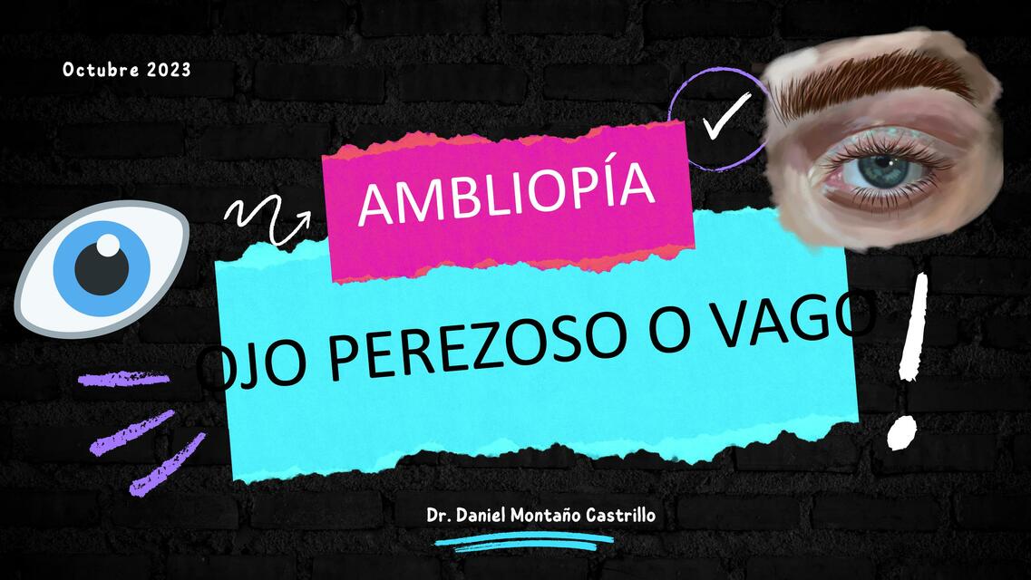 Ambliopia