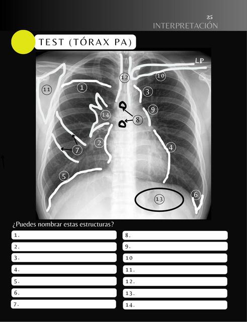 RADIOGRAFÍA DE TÓRAX NORMAL HOJAS DE ESTUDIO