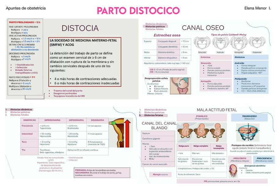 PARTO DISTOCICO