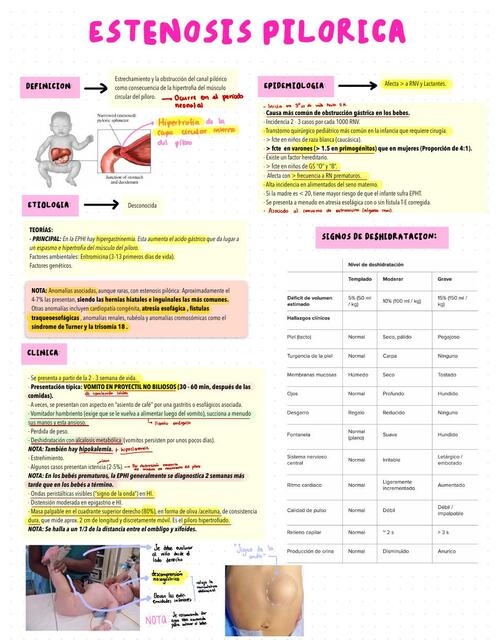 ESTENOSIS HIPERTROFICA DEL PILORO