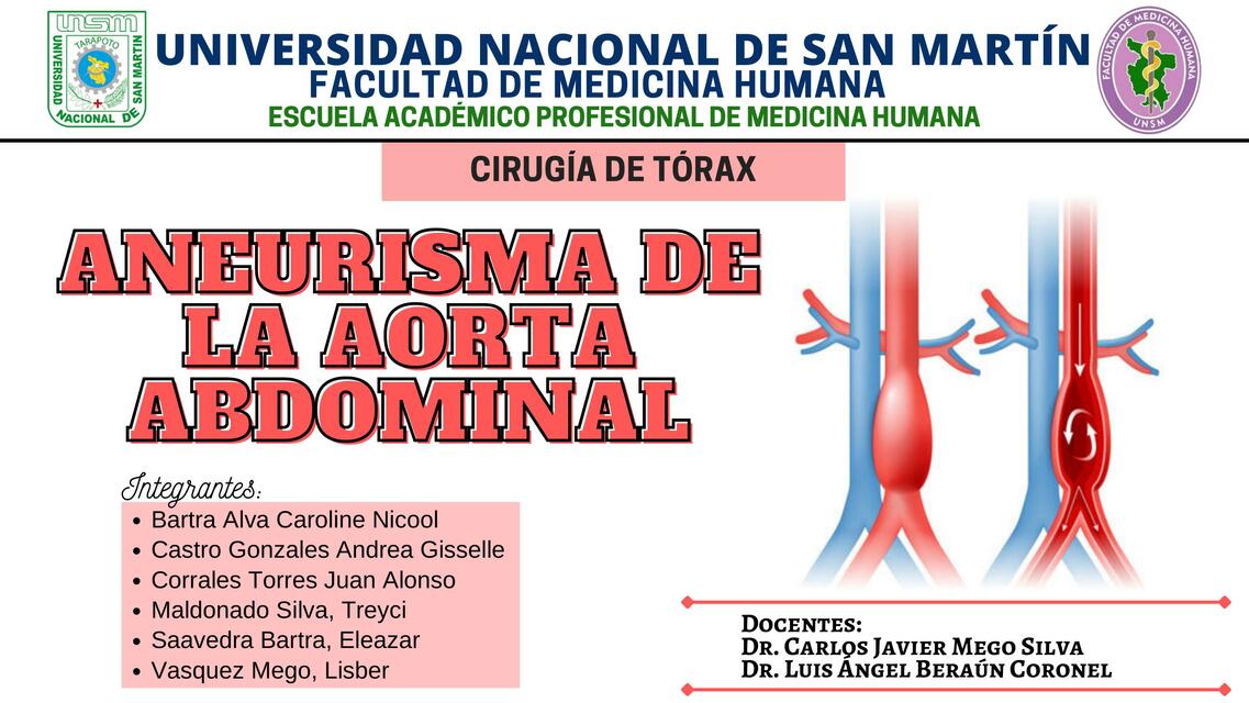 Aneurisma de la aorta abdominal 