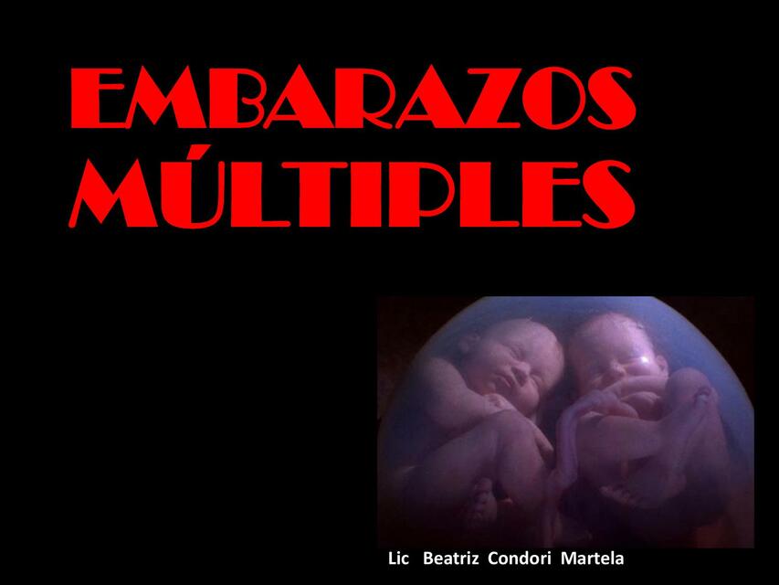 Embarazo multiples 