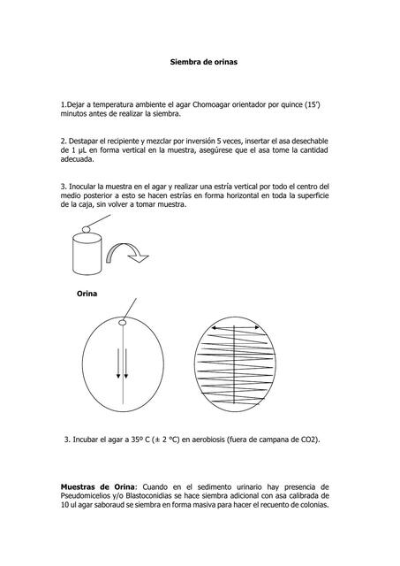 Siembra de orina