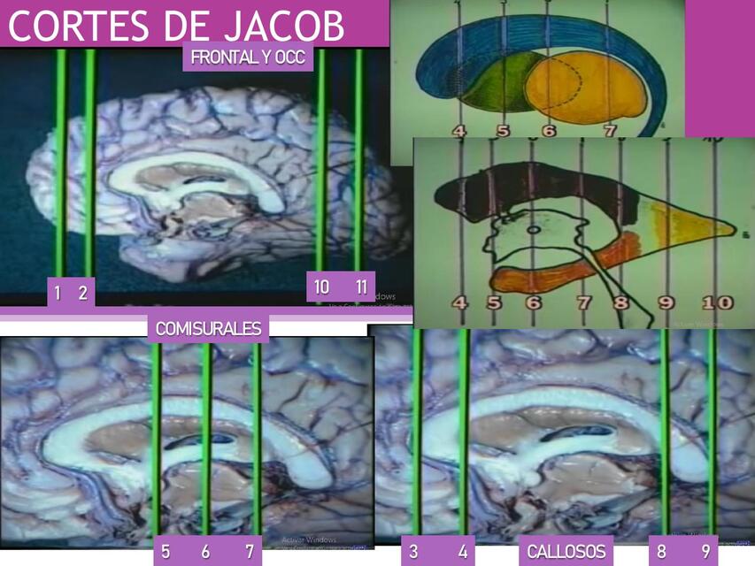 Cortes de Jacob 