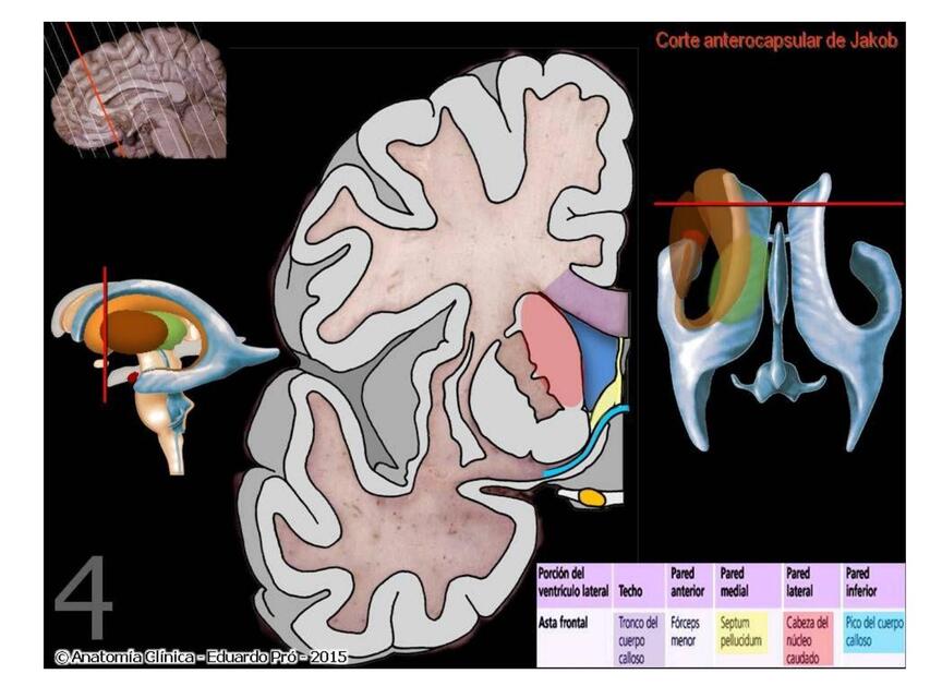 Cavidades Ventriculares 