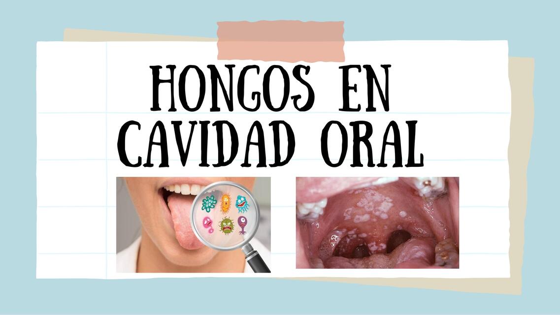 Hongos en cavidad oral 