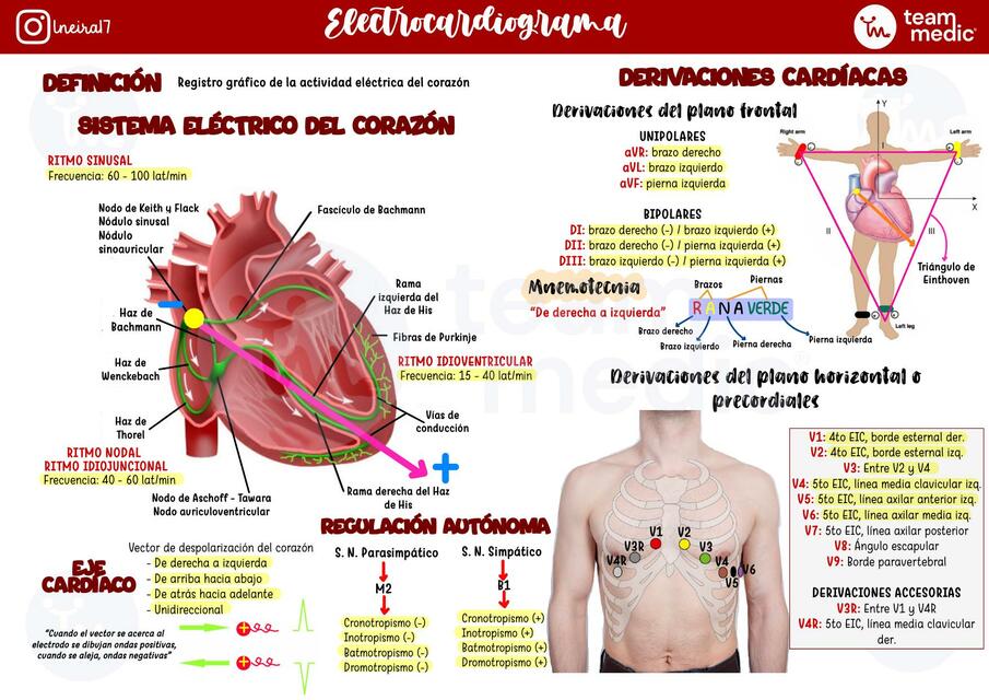 EKG 1