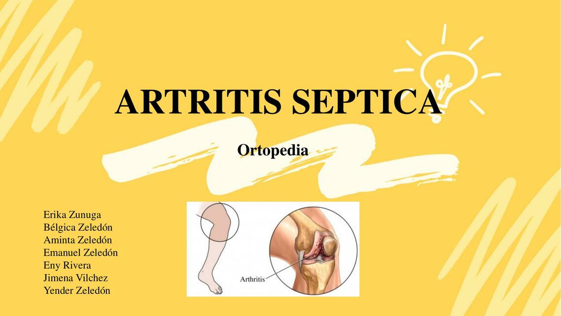 Artritis séptica 