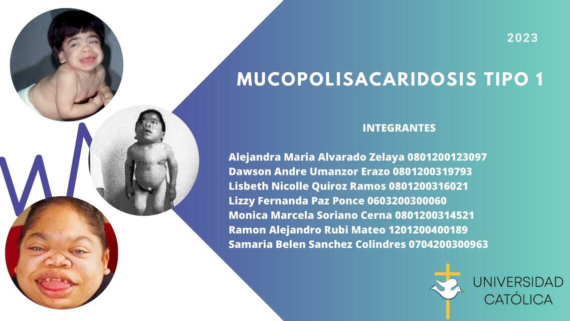 Mucopolisacaridosis Tipo 1