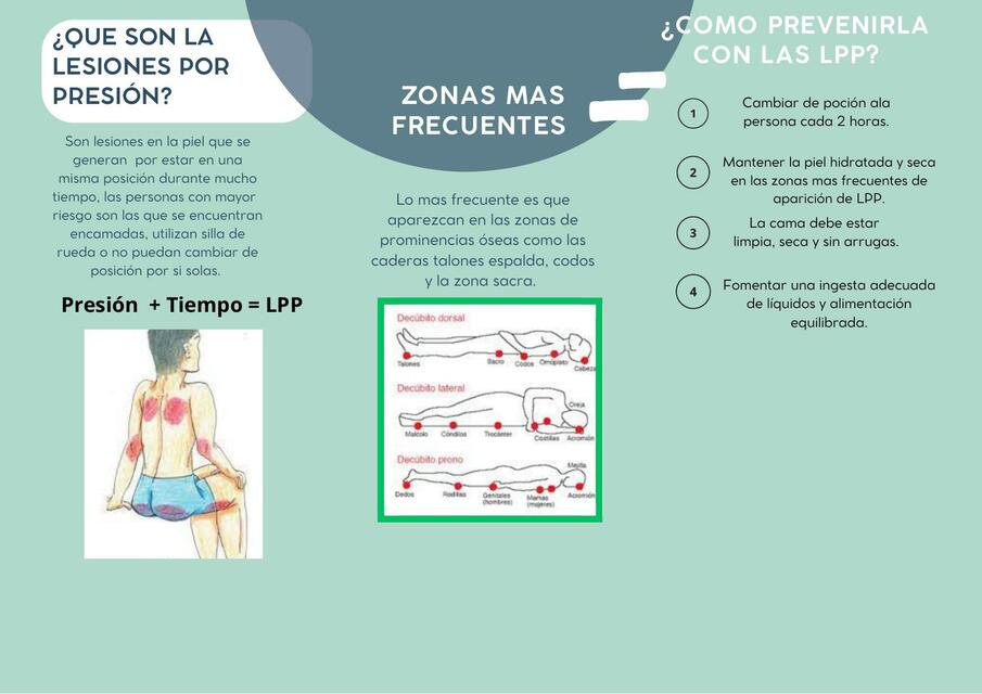 Que son la lesiones por presión 