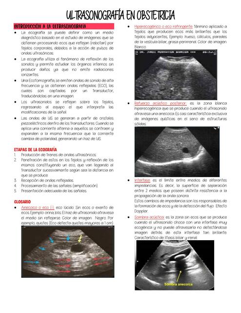 Ultrasonografía en obstetricia 