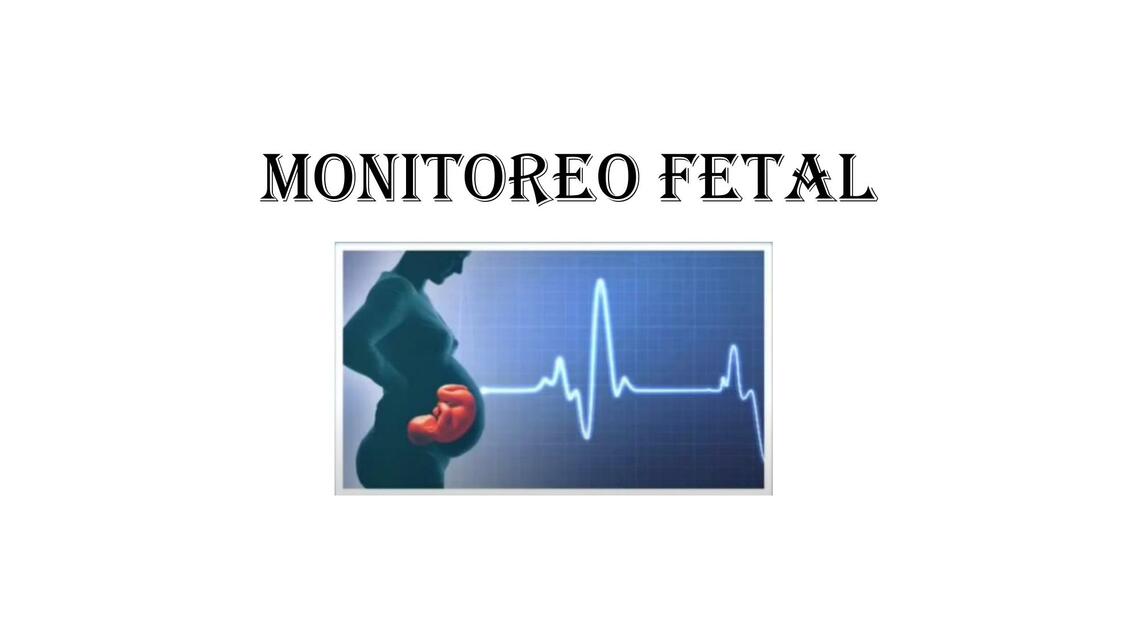 MONITOREO FETAL