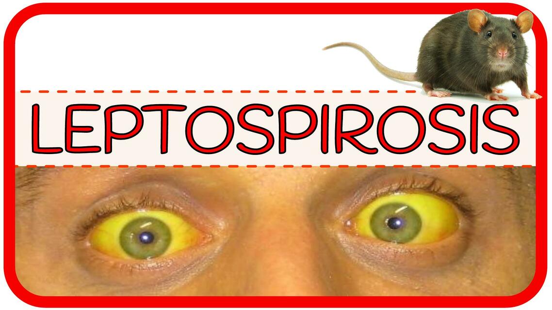 Leptospirosis PDF