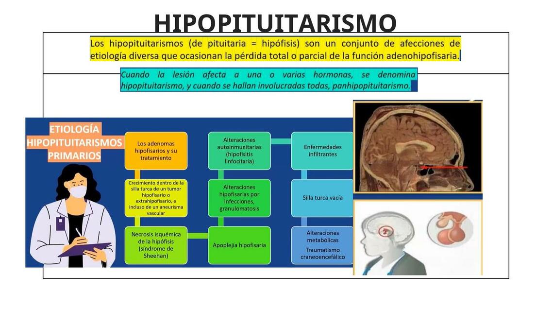 Hipopituitarismo: O Que É, Sintomas, Causas E Tratamento – TGIPE