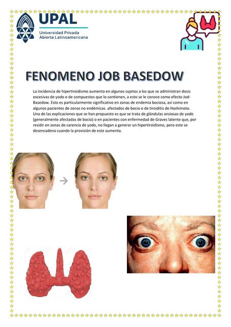 Fenómeno Job Basedow