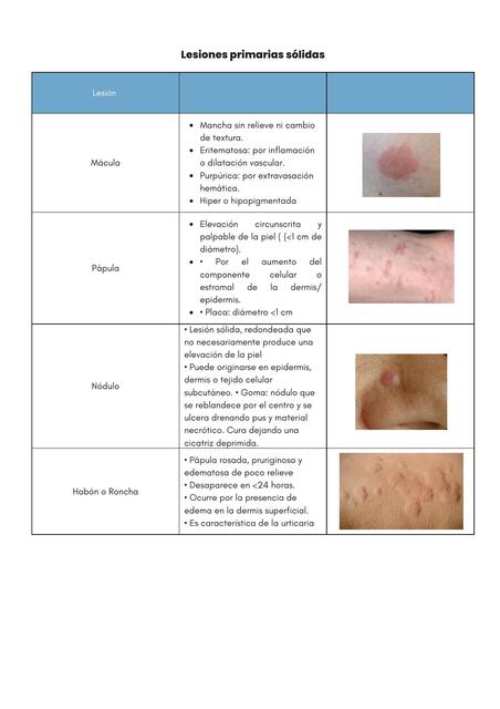 Lesiones primarias sólidas 