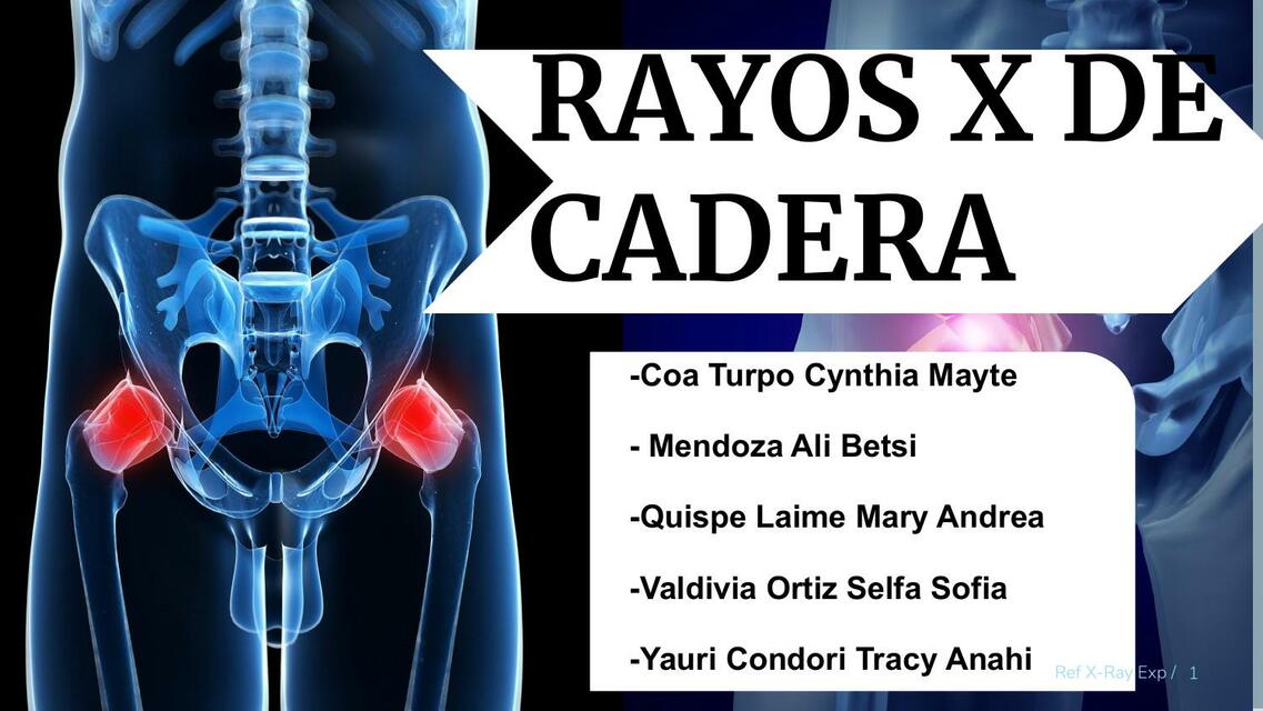 Rayos de x cadera 