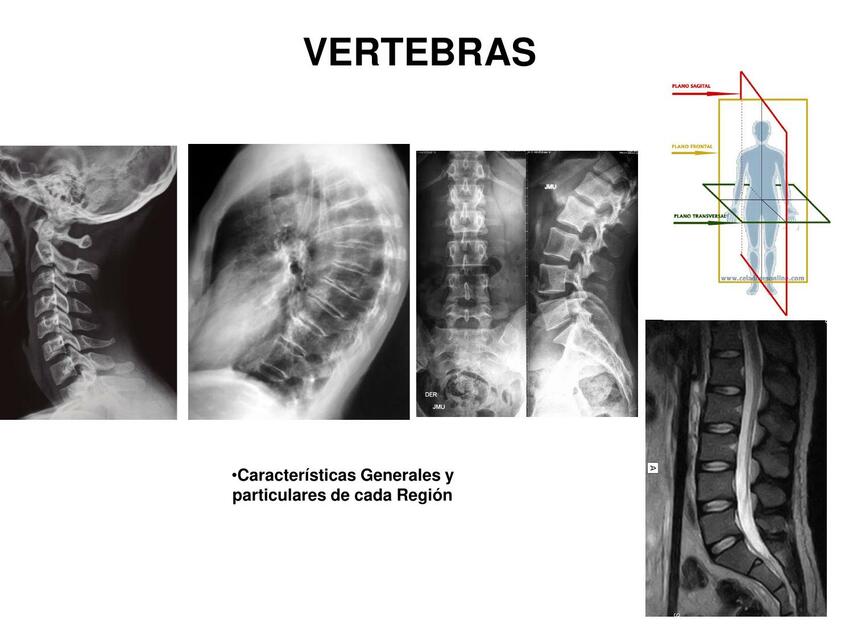 Columna vertebral