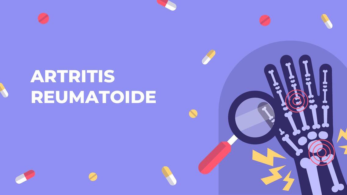 Artritis Reumatoide 