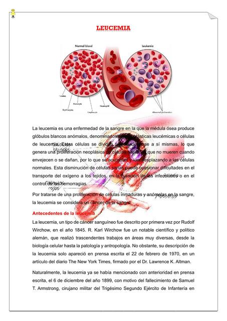 Leucemia 