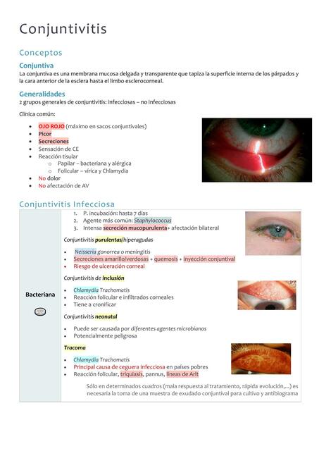 Conjuntivitis 