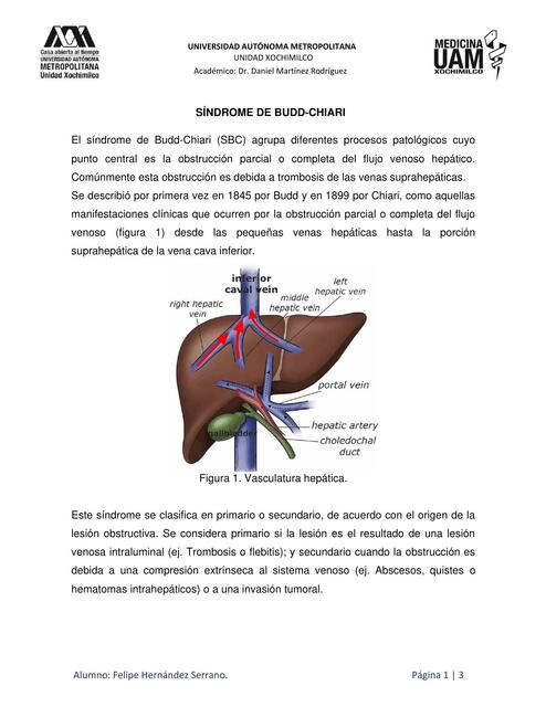 Síndrome de Budd- Chiari