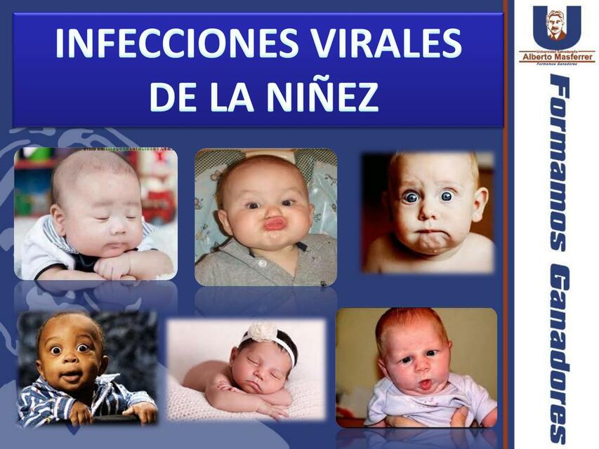 Infecciones Virales de la Niñez 