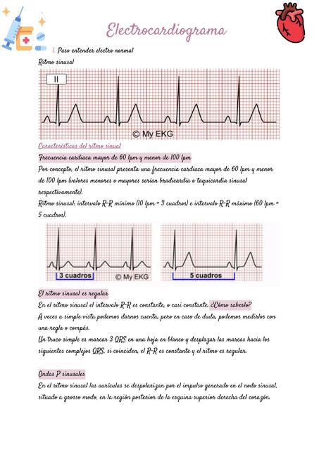 Electrocardiograma 