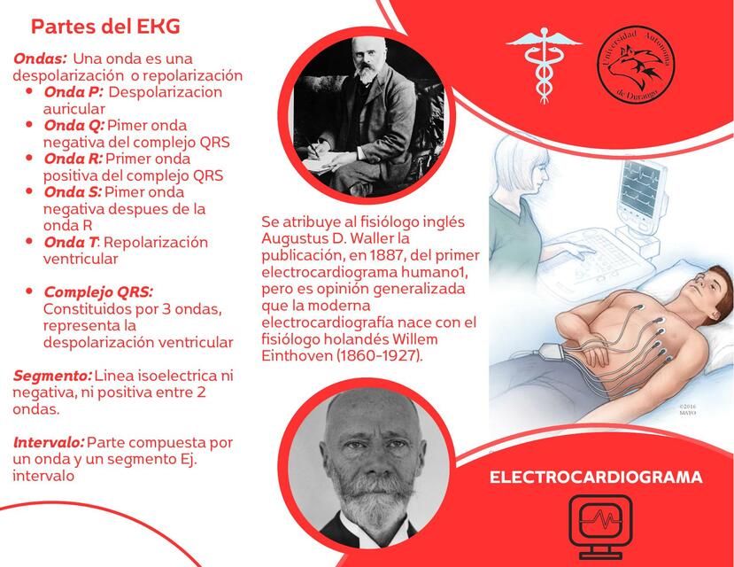 Partes del EKG 