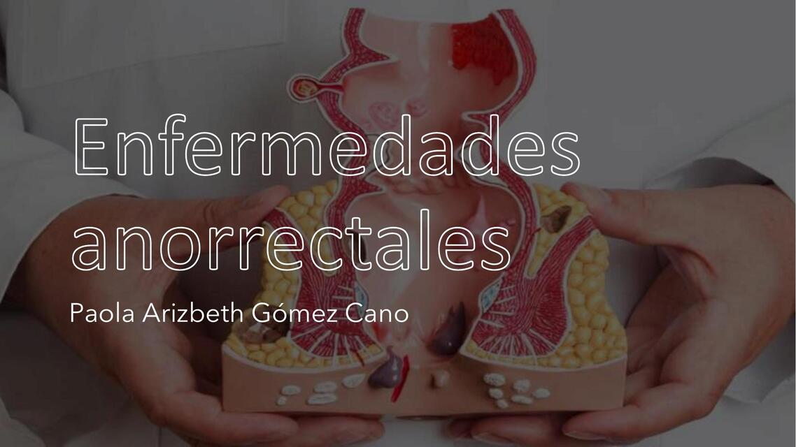 Enfermedades anorrectales 