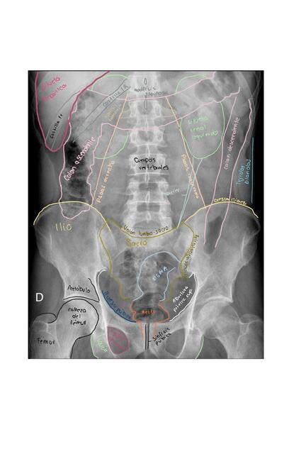 Radiologia de abdomen