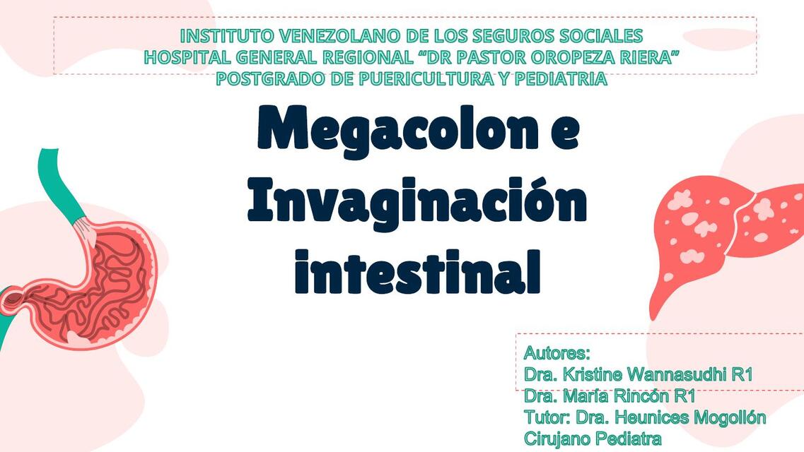 Megacolon e invaginación intestinal 